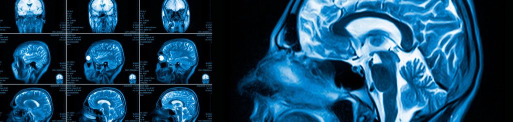 neurología